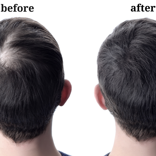 Grow by 8 Organic Shampoo |Sulphate-Free | Paraben-Free