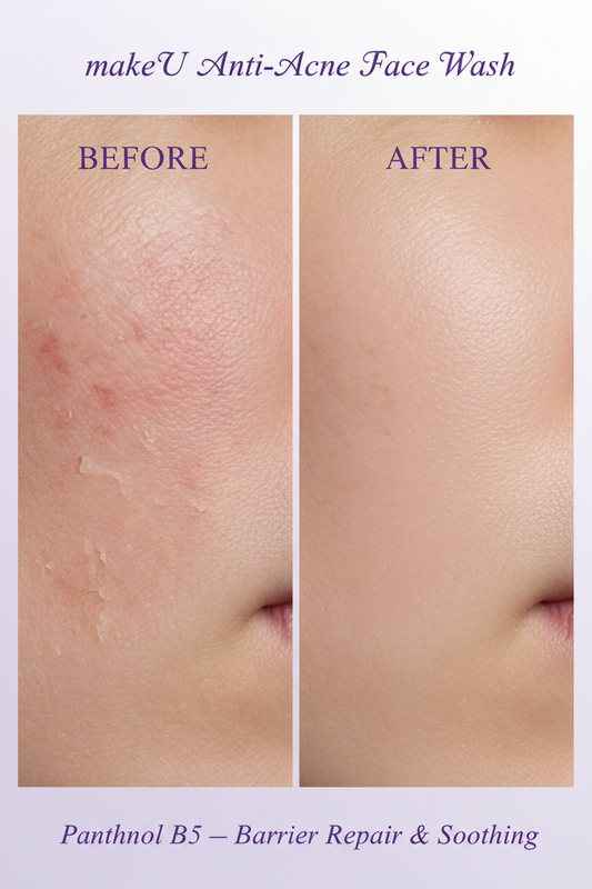 Panthenol B5 Before After