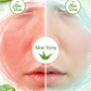 Aloe Vera Before After