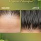 Organic Hair Growth Shampoo | Soapberry