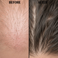 Anti-Hair Fall Before After