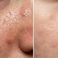 Anti-Acne Facewash Salicylic+ Rice Power Duo