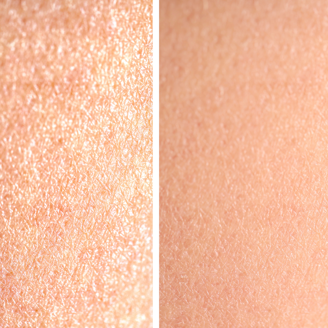 Anti-Acne Facewash Salicylic+ Rice Power Duo