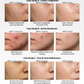 Anti-Acne & Glow Serum | Tea Tree, Aloe Vera, Niacinamide