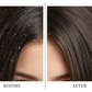 Dandruff Before & After