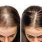 Organic Hair Growth Oil for Hair Fall