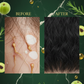 Hair Growth