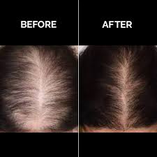 Grow by 8 Organic Oil