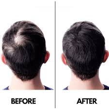 Organic Hair Care Duo