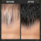 Men Hair Loss