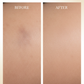 Niacinamide B3 Before After