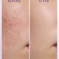 Panthenol B5 Before After