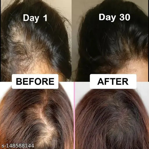 Special Offer Organic Hair Solution