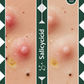 Salicylic Acid Before After