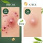 Tea Tree Before After