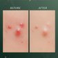 Tea Tree - makeU Serum