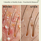 Unhealthy to Healthy Scalp