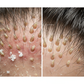Unhealthy vs Healthy Scalp